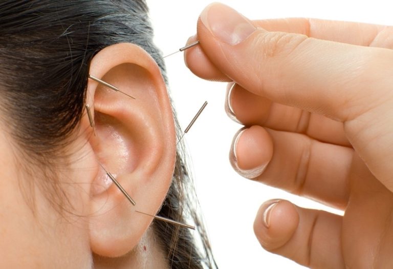 Integrating Auricular Acupuncture into Holistic Wellness Routines