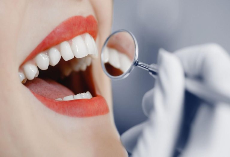 Importance of Regular Dental Check-Up