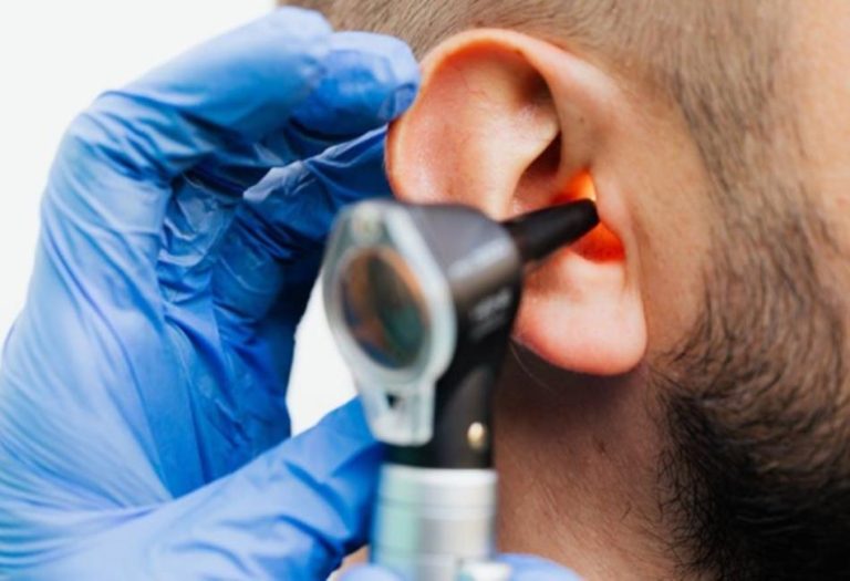 The Importance of Ear Wax Removal for Your Health: A Comprehensive Guide