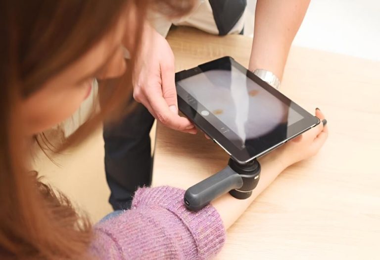 How AI Is Changing the Way We Detect Skin Cancer
